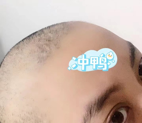 冰冰在8月16日,已经剃掉了头发。