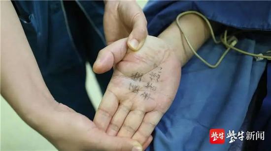 病人的手心里写着:“医生,辛苦您了” 张鑫 摄