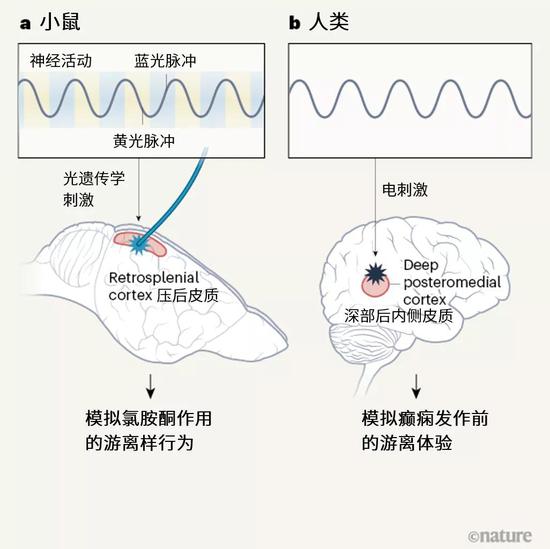 图1 | 诱导游离状态。游离是一种意识改变状态，让人感觉与现实脱离。这种状态能通过药物氯胺酮诱导，也会在癫痫发作前出现。a，光遗传学技术能调控光照射下的神经元活动。Vesuna等人[1]调控了小鼠的压后皮质脑区内的单层神经元。研究团队利用蓝光刺激神经元活动，再用黄光抑制这种活动，结果产生了低频的神经元振荡，与接受氯胺酮的小鼠身上见到的类似。这种振荡能引起具有游离特征的行为。b，作者表明，癫痫患者的对应脑区（被称为深部后内侧皮质）会在癫痫发作前出现相同的振荡。对这一脑区进行电刺激，会引发相同的振荡和游离体验。这两项实验表明，在不同物种中，一个小块脑区发生低频振荡会引起游离。